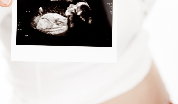 Las ecografías del embarazo